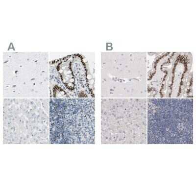 Immunohistochemistry-Paraffin: Th-POK Antibody [NBP1-88077]