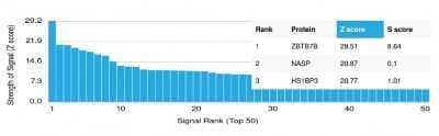 Protein Array: Th-POK Antibody (PCRP-ZBTB7B-1B6) - Azide and BSA Free [NBP3-08311]