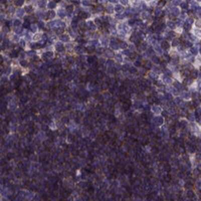 Immunohistochemistry-Paraffin: Themis Antibody [NBP2-38183]