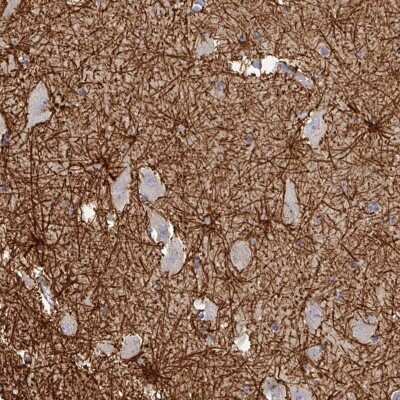 Immunohistochemistry-Paraffin: Thimet Oligopeptidase/THOP1 Antibody [NBP2-55258]