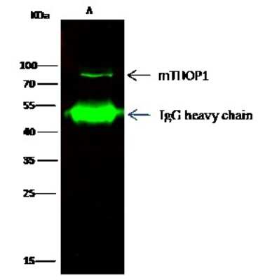 Immunoprecipitation: Thimet Oligopeptidase/THOP1 Antibody [NBP2-98355]