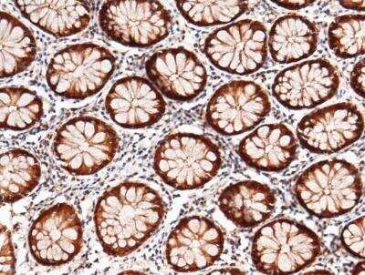 Immunohistochemistry-Paraffin: Thioredoxin-1 Antibody (214) [NBP2-89460]