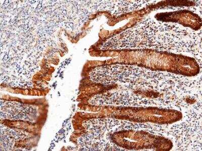 Immunohistochemistry-Paraffin: Thioredoxin-1 Antibody (214) [NBP2-89460]