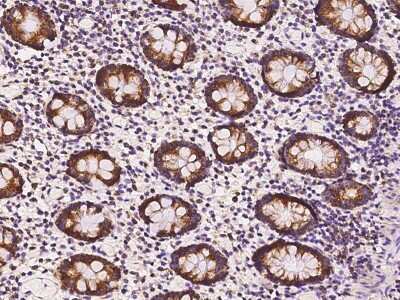 Immunohistochemistry-Paraffin: Thioredoxin-2 Antibody [NBP3-00013]