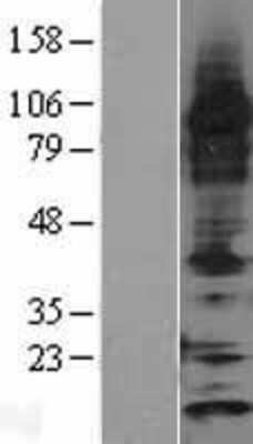 Western Blot: Thioredoxin-2 Overexpression Lysate [NBP2-04338]