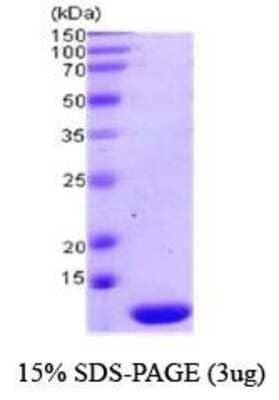 SDS-PAGE: Recombinant Human Thioredoxin-2 Protein [NBC1-18542]