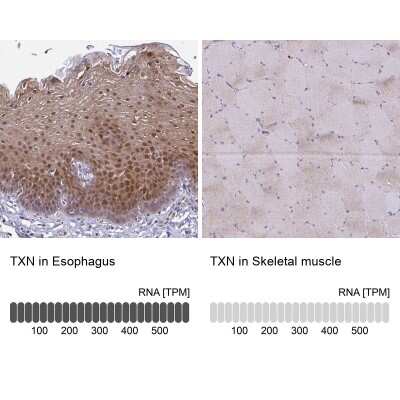 Immunohistochemistry-Paraffin: Thioredoxin-1 Antibody [NBP2-48873]