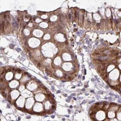 Immunohistochemistry-Paraffin: Thioredoxin-1 Antibody [NBP2-48873]