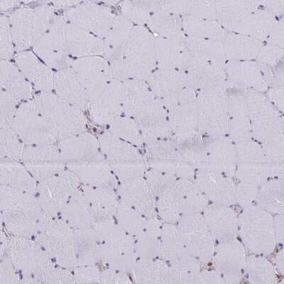 Immunohistochemistry-Paraffin: Thioredoxin-1 Antibody [NBP2-49191]