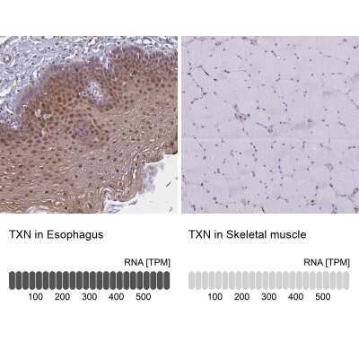 Immunohistochemistry-Paraffin: Thioredoxin-1 Antibody [NBP2-49191]