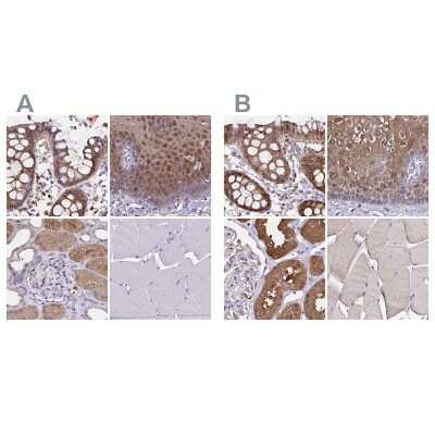 Immunohistochemistry-Paraffin: Thioredoxin-1 Antibody [NBP2-49191]