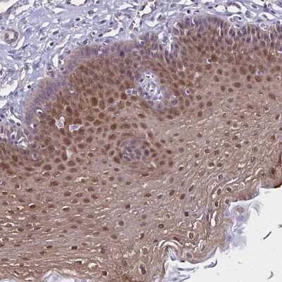 Immunohistochemistry-Paraffin: Thioredoxin-1 Antibody [NBP2-49191]