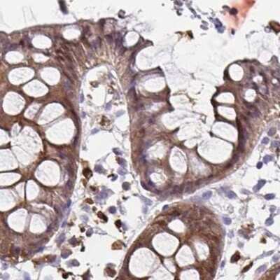 Immunohistochemistry-Paraffin: Thioredoxin-1 Antibody [NBP2-49191]