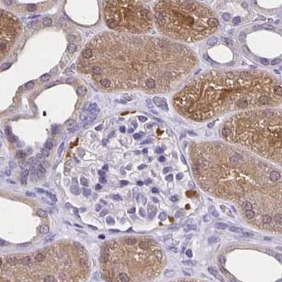 Immunohistochemistry-Paraffin: Thioredoxin-1 Antibody [NBP2-49191]