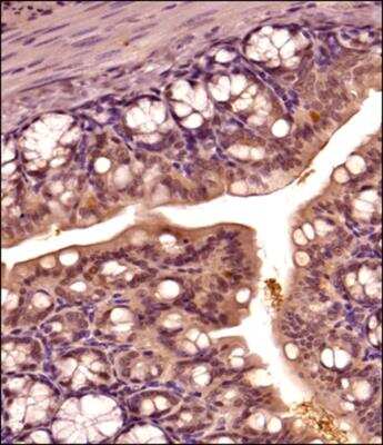 Immunohistochemistry-Paraffin: Thioredoxin-1 Antibody - BSA Free [NBP2-52983]