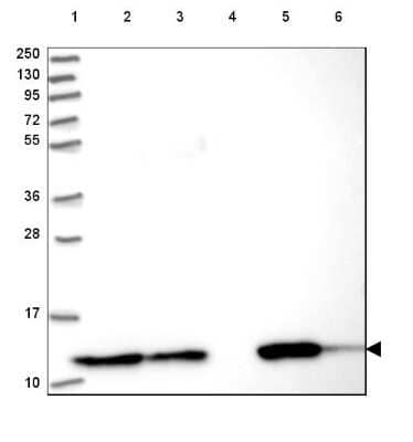 Western Blot: Thioredoxin-1 Antibody [NBP2-48873]