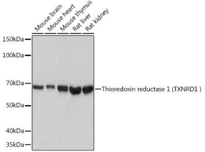 Western Blot: Thioredoxin Reductase 1/TRXR1 Antibody (7P1J4) [NBP3-16470]