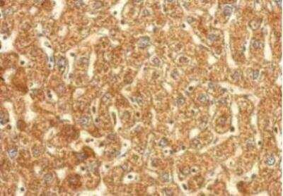 Immunohistochemistry-Paraffin: Thioredoxin Reductase 1/TRXR1 Antibody [NBP1-33210]