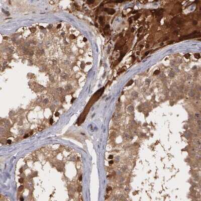 Immunohistochemistry-Paraffin: Thioredoxin Reductase 1/TRXR1 Antibody [NBP1-81791]