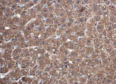 Immunohistochemistry-Paraffin: Thioredoxin Reductase 1/TRXR1 Antibody [NBP2-20619]