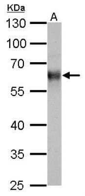 Western Blot: Thioredoxin Reductase 1/TRXR1 Antibody [NBP1-33210]