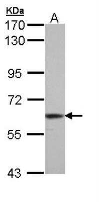 Western Blot: Thioredoxin Reductase 1/TRXR1 Antibody [NBP1-33210]