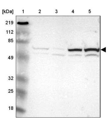 Western Blot: Thioredoxin Reductase 1/TRXR1 Antibody [NBP1-81791]