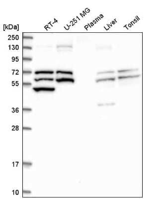 Western Blot: Thioredoxin Reductase 1/TRXR1 Antibody [NBP2-55363]