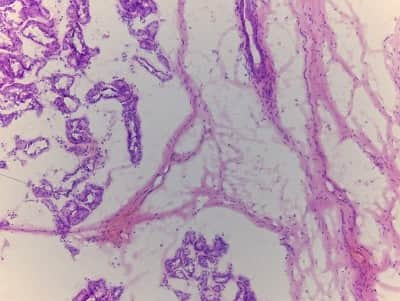 Hematoxylin & Eosin Stain: Throat Tissue Slides (Adult Normal)- Frozen [NBP2-77589]