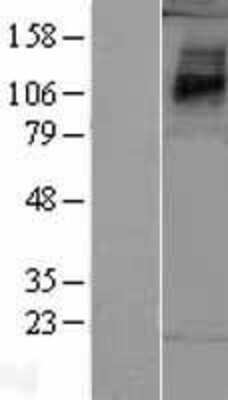 Western Blot: PAR1/Thrombin Receptor Overexpression Lysate [NBP2-04210]