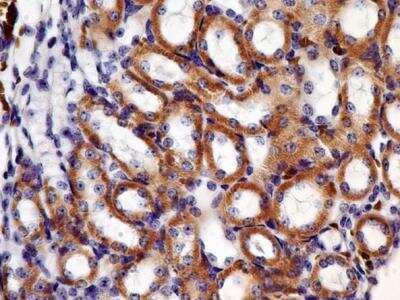 Immunohistochemistry-Paraffin: Thrombomodulin/BDCA-3 Antibody (4D8.2C6) - BSA Free [NBP2-36496]