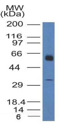 Western Blot: Thrombomodulin/BDCA-3 Antibody (6C8.2F9)Azide and BSA Free [NBP2-80979]