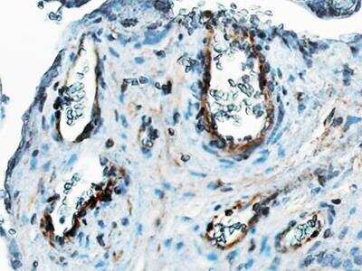 Immunohistochemistry-Paraffin: Thrombomodulin/BDCA-3 Antibody (6C8.2F9) - BSA Free [NBP2-42213]