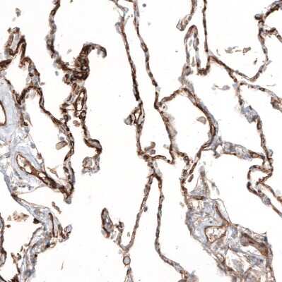 Immunohistochemistry-Paraffin: Thrombomodulin/BDCA-3 Antibody [NBP1-88133]
