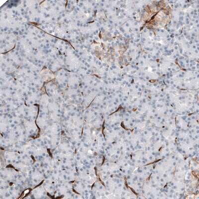 Immunohistochemistry-Paraffin: Thrombomodulin/BDCA-3 Antibody [NBP1-88133]