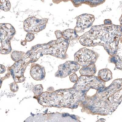 Immunohistochemistry-Paraffin: Thrombomodulin/BDCA-3 Antibody [NBP1-88133]
