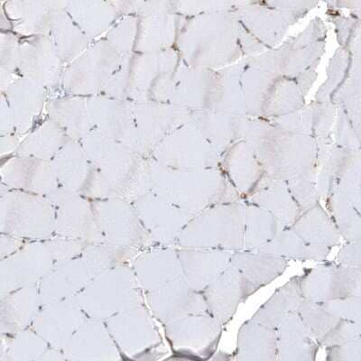 Immunohistochemistry-Paraffin: Thrombomodulin/BDCA-3 Antibody [NBP1-88133]