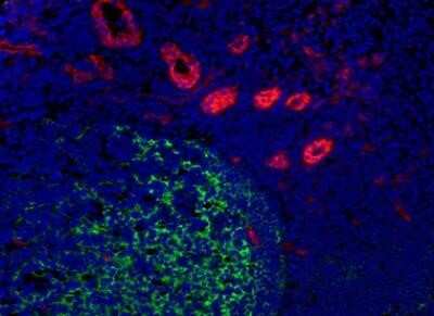 Immunocytochemistry/ Immunofluorescence: Thrombomodulin/BDCA-3 Antibody (QBEND/40) [NB100-64982]