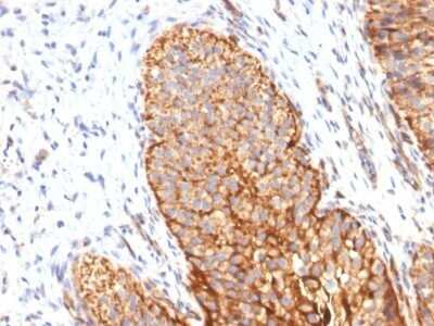 Immunohistochemistry-Paraffin: Thrombomodulin/BDCA-3 Antibody (THBD/1591) - Azide and BSA Free [NBP2-54490]