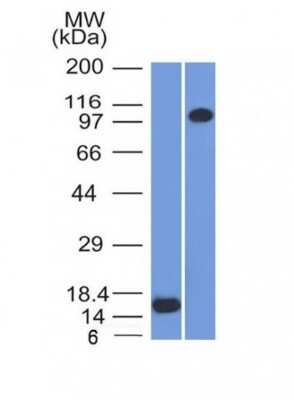 Western Blot: Thrombomodulin/BDCA-3 Antibody (THBD/1591)Azide and BSA Free [NBP2-54490]