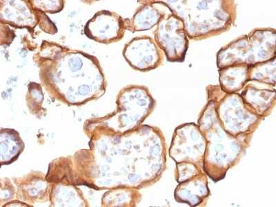 Immunohistochemistry-Paraffin: Thrombomodulin/BDCA-3 Antibody (THBD/1591) [NBP2-53206]