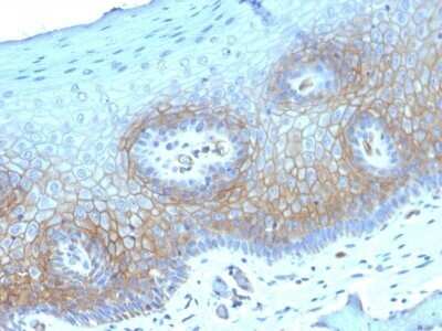 Immunohistochemistry-Paraffin: Thrombomodulin/BDCA-3 Antibody (THBD/1782) - Azide and BSA Free [NBP2-54496]