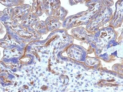 Immunohistochemistry-Paraffin: Thrombomodulin/BDCA-3 Antibody (THBD/1782) [NBP2-53273]