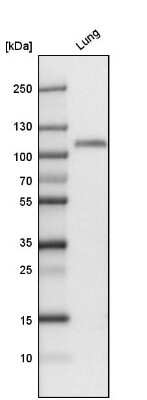 Western Blot: Thrombomodulin/BDCA-3 Antibody [NBP1-88133]