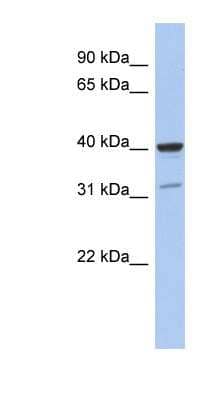 Western Blot: Thrombopoietin/THPO Antibody [NBP1-59293]