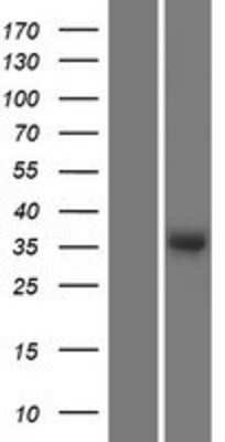 Western Blot: Thrombopoietin/THPO Overexpression Lysate [NBP2-10672]