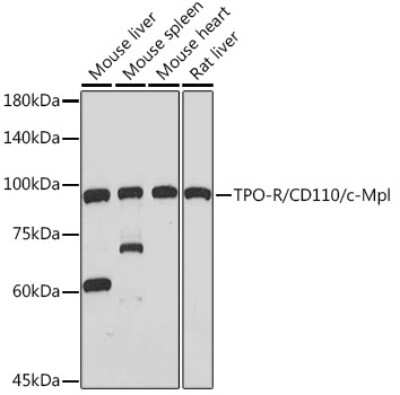 Western Blot: Thrombopoietin R/Tpo R Antibody (5Q9Z6) [NBP3-15880]