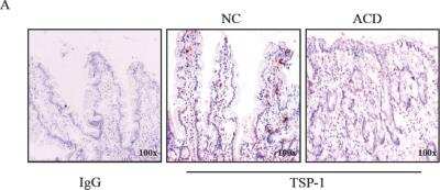 Immunohistochemistry: Thrombospondin-1 Antibody (A6.1) [NB100-2059]