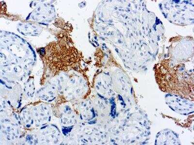 Immunohistochemistry-Paraffin: Thrombospondin-1 Antibody (A6.1) [NB100-2059]