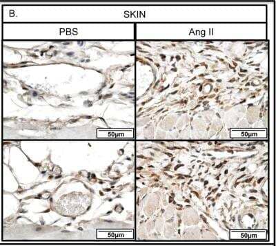 Immunohistochemistry-Paraffin: Thrombospondin-1 Antibody (A6.1) [NB100-2059]